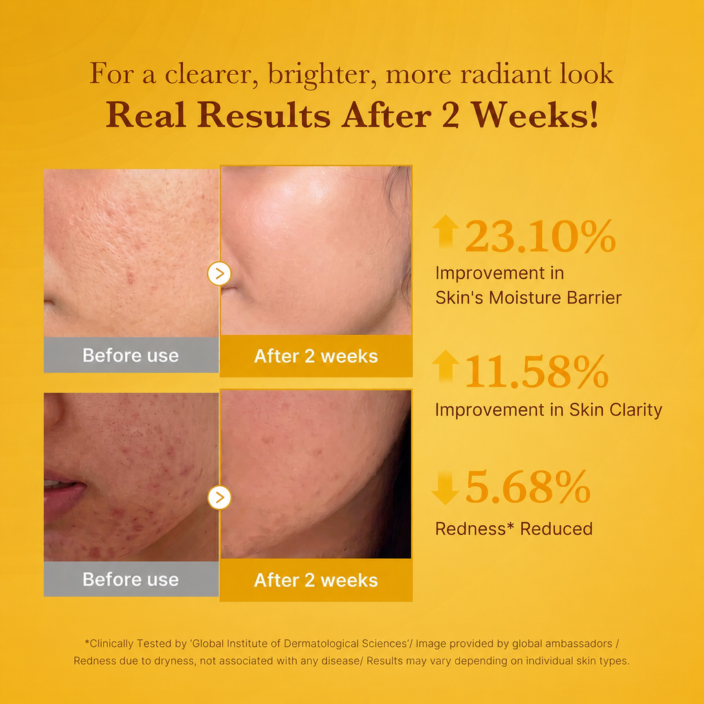 Kojic Acid Turmeric Serum